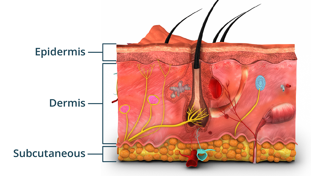 layers-of-the-skin-4f3205
